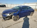2015 Chrysler 200 Passenger Axle Shaft 3.6L Fwd Used 117K Miles Oem 447-03255R. Fixed Price $84.95.